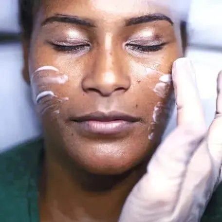 Facial treatment